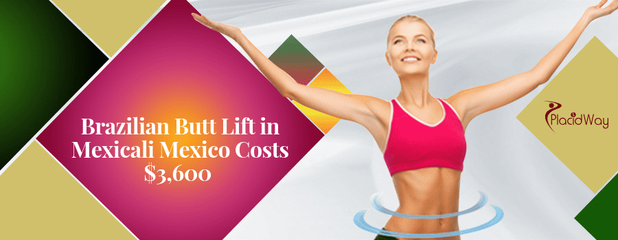 BBL Cost in Mexico