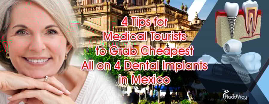 All on 4 Dental Implant in Mexico