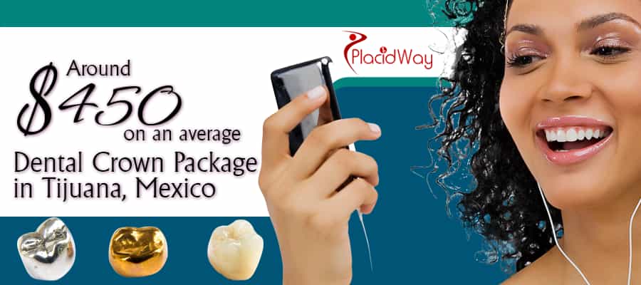 The cost of Dental Crown Package in Tijuana, Mexico is around $400 on an average