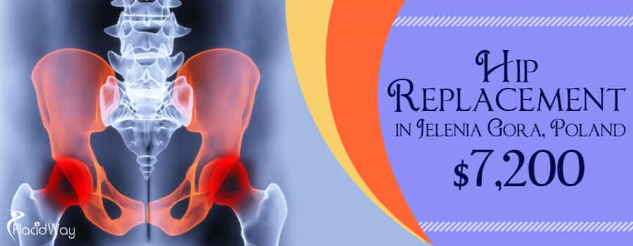 Cost of Hip Replacement in Jelenia Gora, Poland