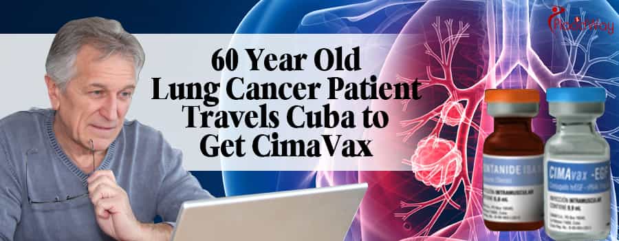 60-Year-Old Lung Cancer Patient Travels Cuba to Get Cimavax1
