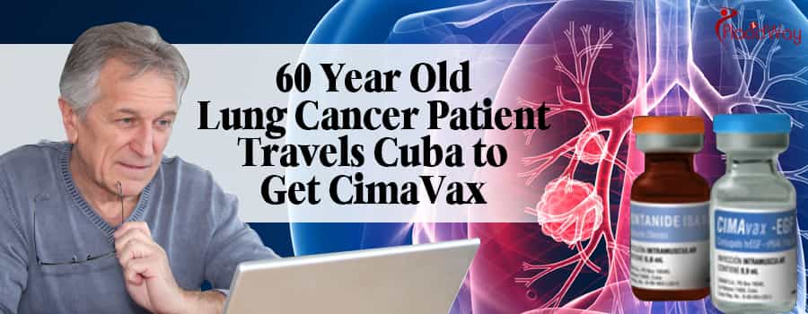 60-Year-Old Lung Cancer Patient Travels Cuba to Get Cimavax1