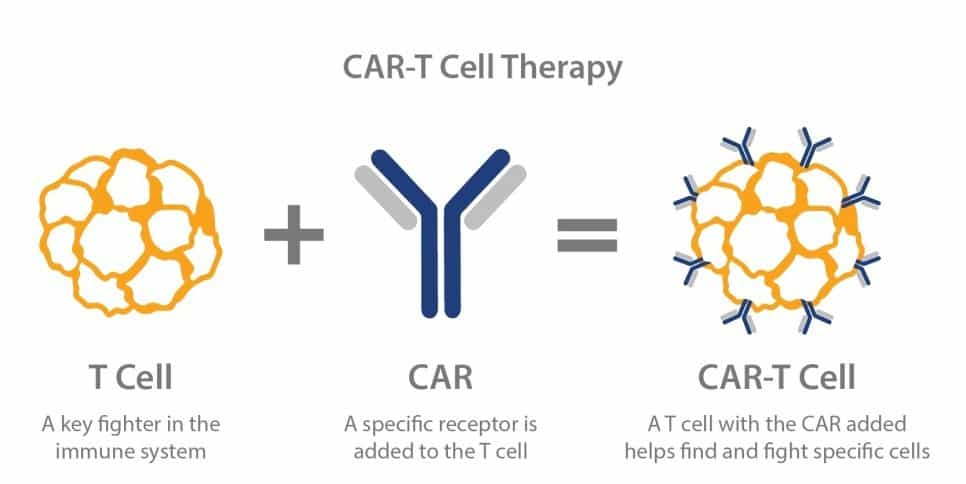 CAR - T Treatment for Cancer