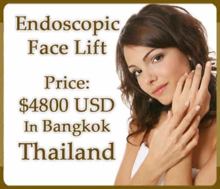 Endoscopic Face lift in Bangkok, Thailand