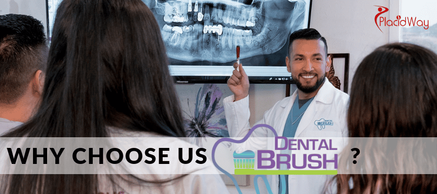 Why Should You Choose Dental Brush?