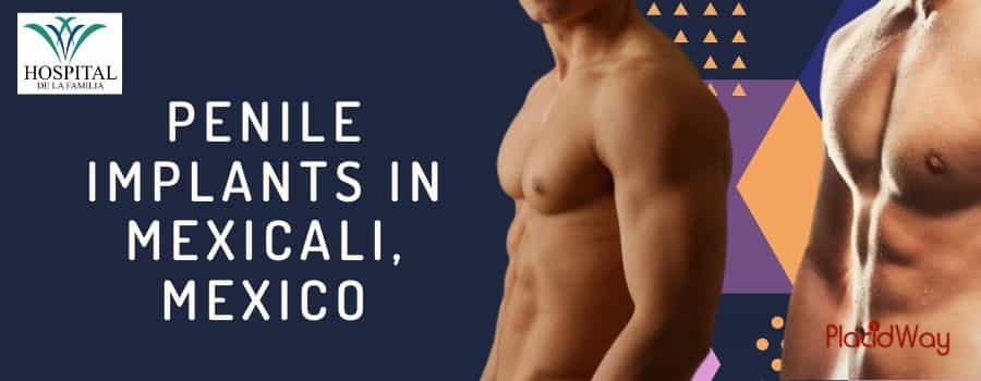 Penile Implant Surgery ​in Mexico, Mexicali