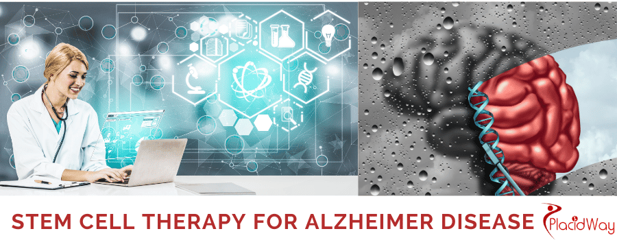 Stem Cell Therapy For Alzheimer Disease