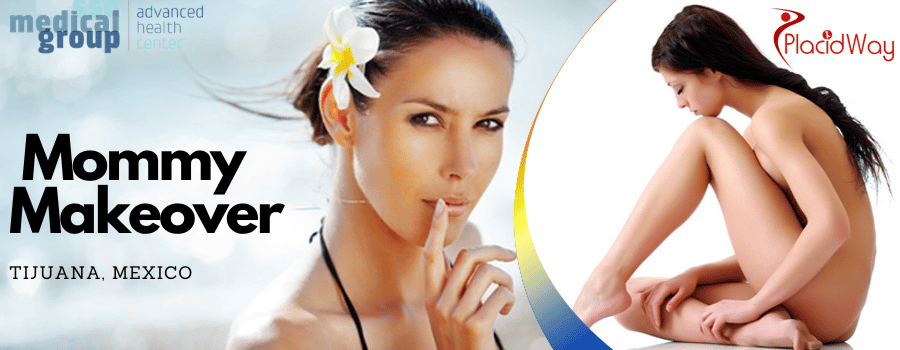 Mommy Makeover in Tijuana, Mexico