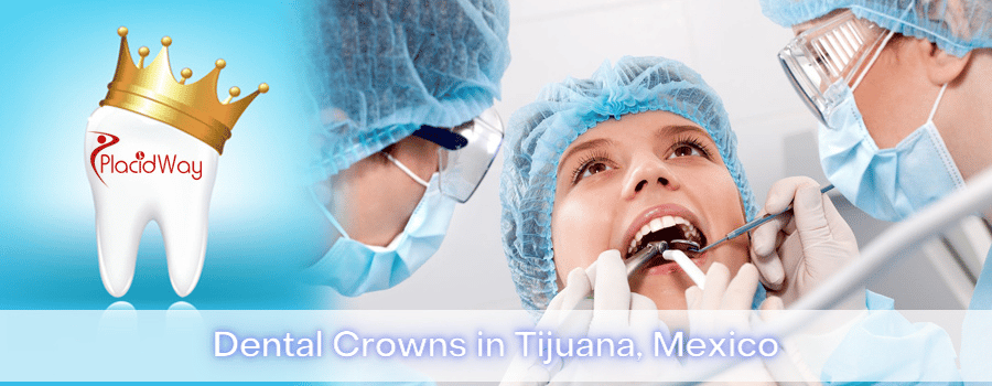 Dental Crowns in Tijuana, Mexico