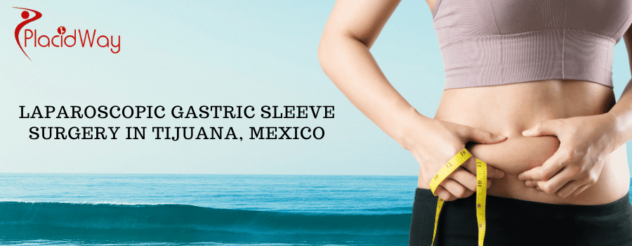 Gastric Sleeve Surgery in Tijuana, Mexico