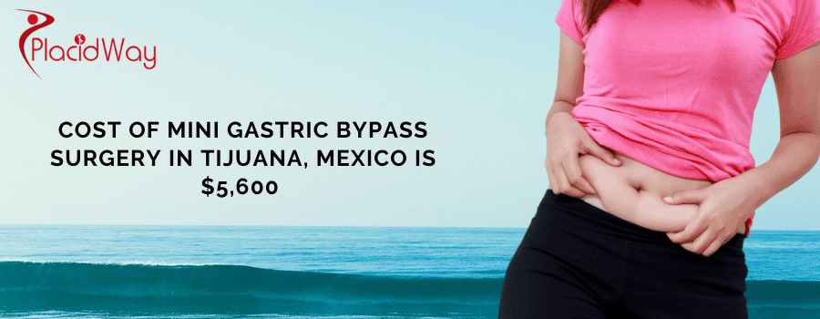 Cost of Mini Gastric Bypass in Tijuana, Mexico