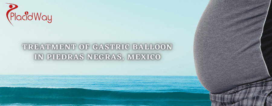 Affordable Gastric Balloon in Piedras Negras, Mexico