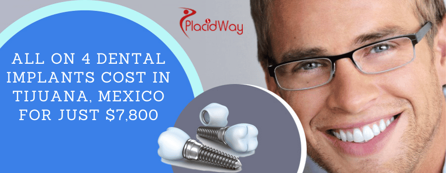 All on 4 Dental Implants Cost in Tijuana, Mexico