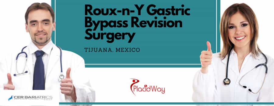 Roux-n-Y gastric Bypass revision in Tijuana, Mexico