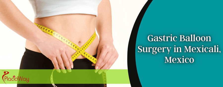 Gastric Balloon Surgery in Mexicali, Mexico