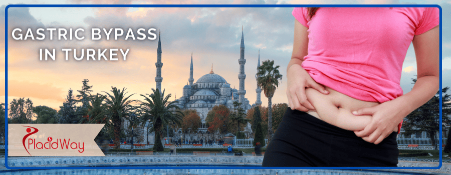 Gastric Bypass in Turkey