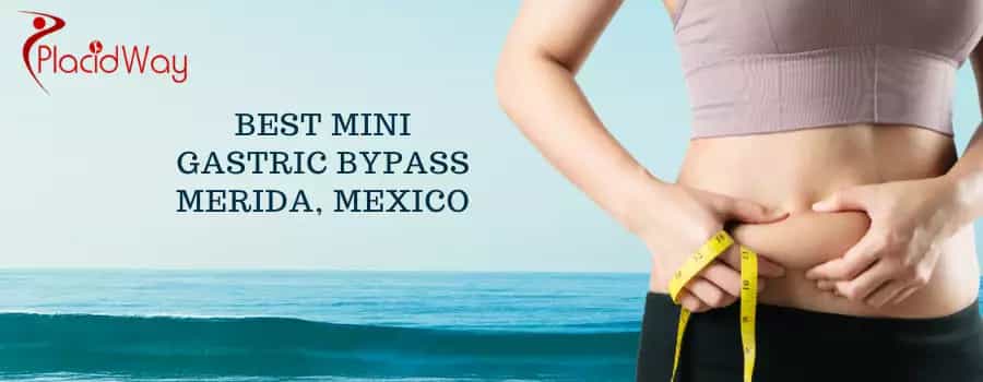 Mini Gastric Bypass in Merida, Mexico