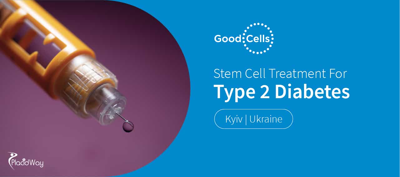Stem Cell Treatment for Diabetes Type 2