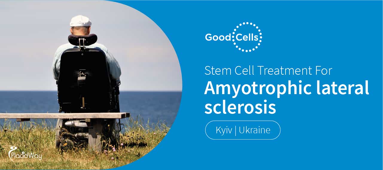 Stem Cell Therapy for ALS