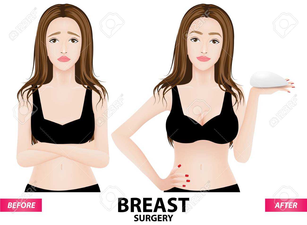 Ssss
