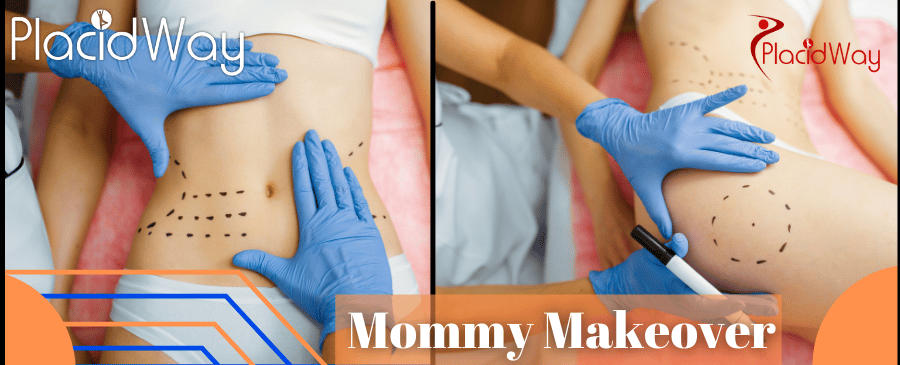 Mommy Makeover in Cancun, Mexico