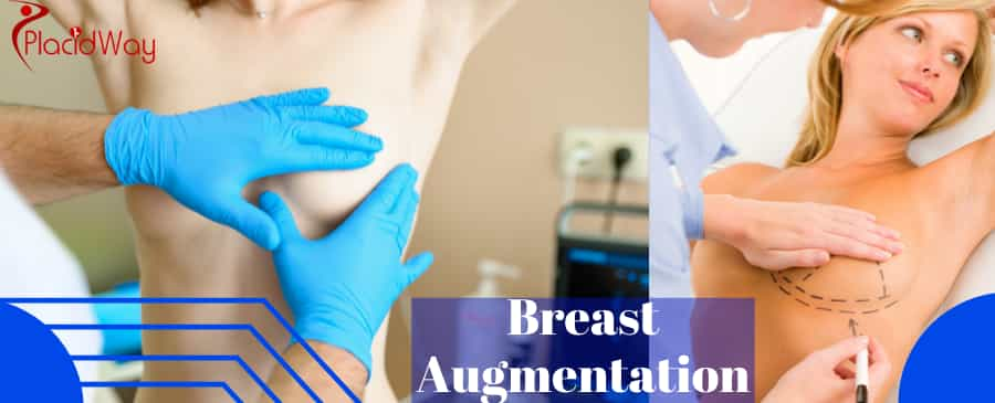 Breast Augmentation in Cancun, Mexico