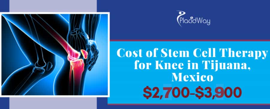 Stem Cell Therapy for Knees Cost in Mexico