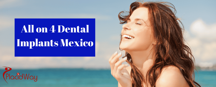 Cheapest All on 4 Dental Implants in Mexico