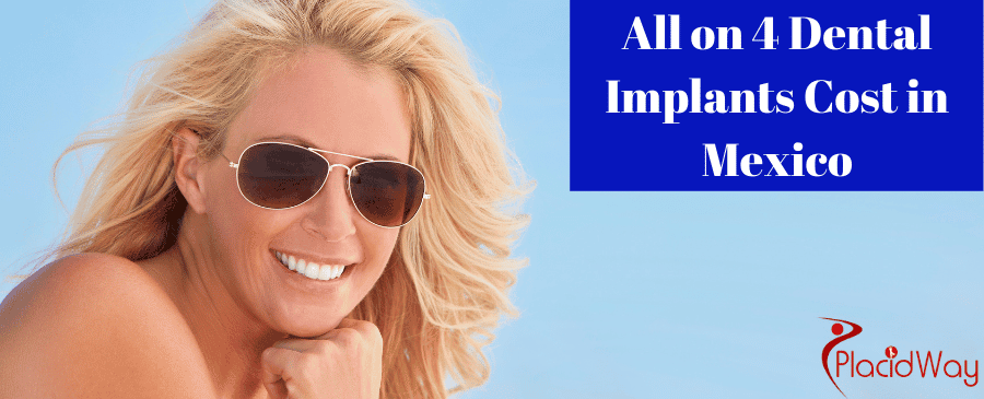 All on 4 Dental Implants in Mexico