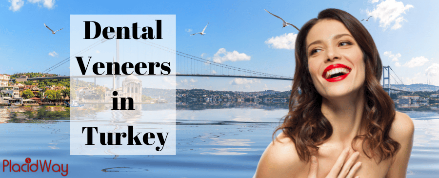 Dental Veneers in Turkey