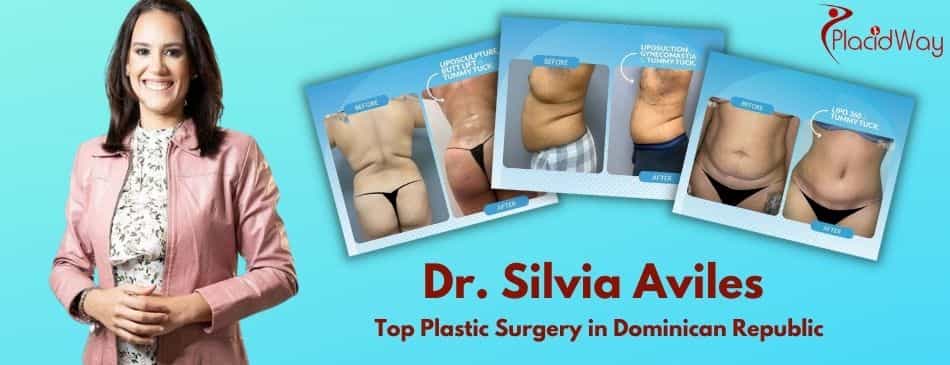 Silvia Aviles - Plastic Surgeon in Santo Domingo, Dominican Republic