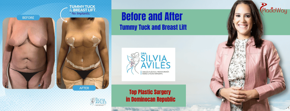 Before and After Tummy Tuck in Dominican Republic 