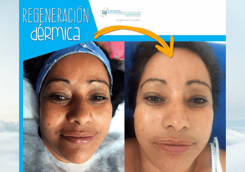 Stem Cell Clinic In Mexico