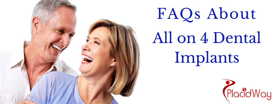 FAQs for all on 4 dental implants