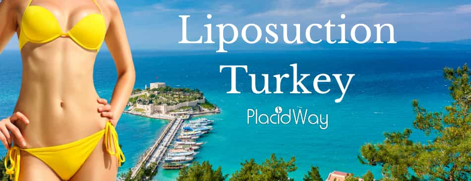 Liposuction in Turkey