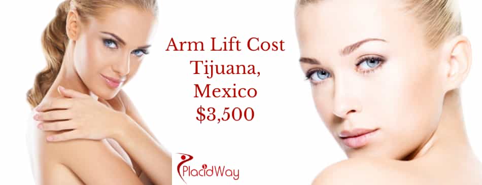 Brachioplasty Cost in Tijuana, Mexico