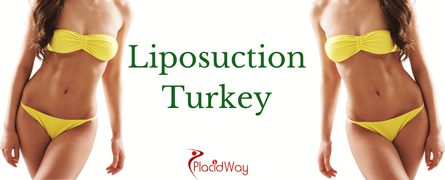 Liposuction in Istanbul, Turkey