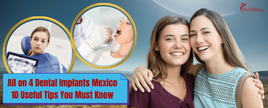 all on 4 dental implants in Mexico
