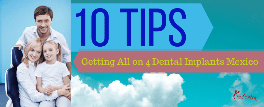 10 Important Tips for Getting All on 4 Dental Implants in Mexico