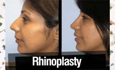 Plastic Surgery in Reynosa Mexico by Hospital Los Lagos