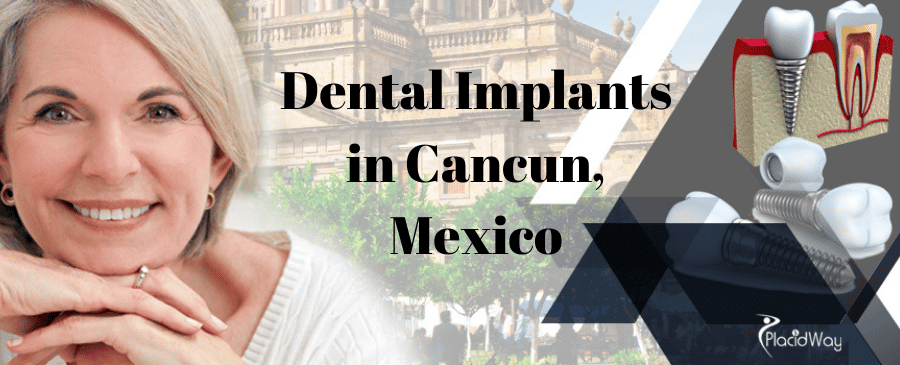 Cheap Dental Implants in Cancun, Mexico