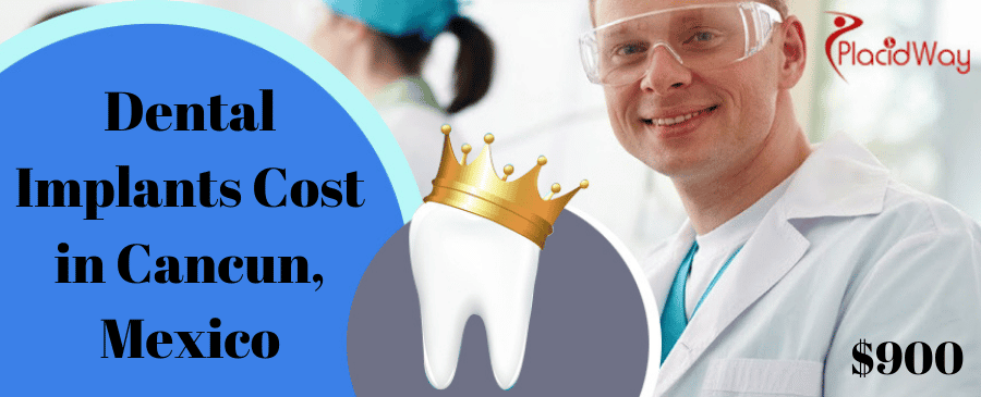Cost of dental Implants in Cancun, Mexico