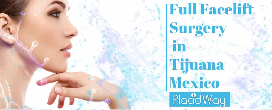 Full Facelift Surgery in Tijuana Mexico