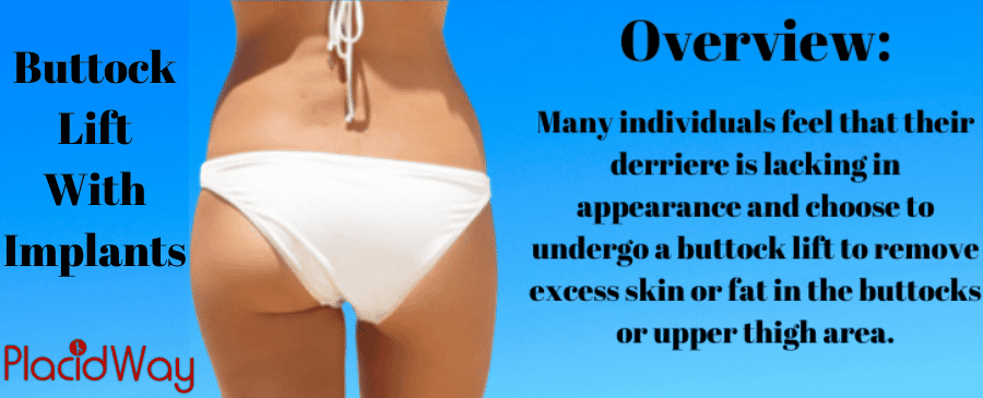 Buttock Lift With Implants overview