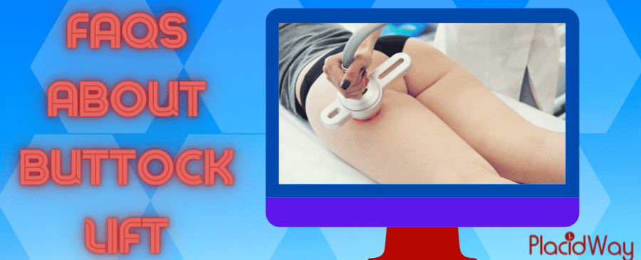 FAQs for Buttock Lift Surgery