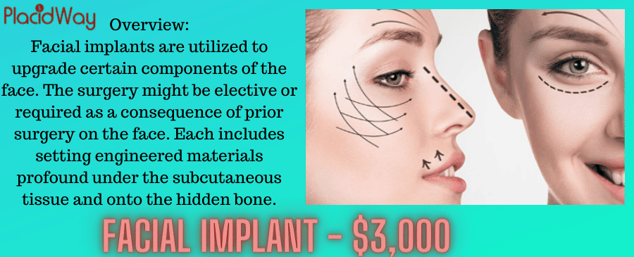 Facial Implants