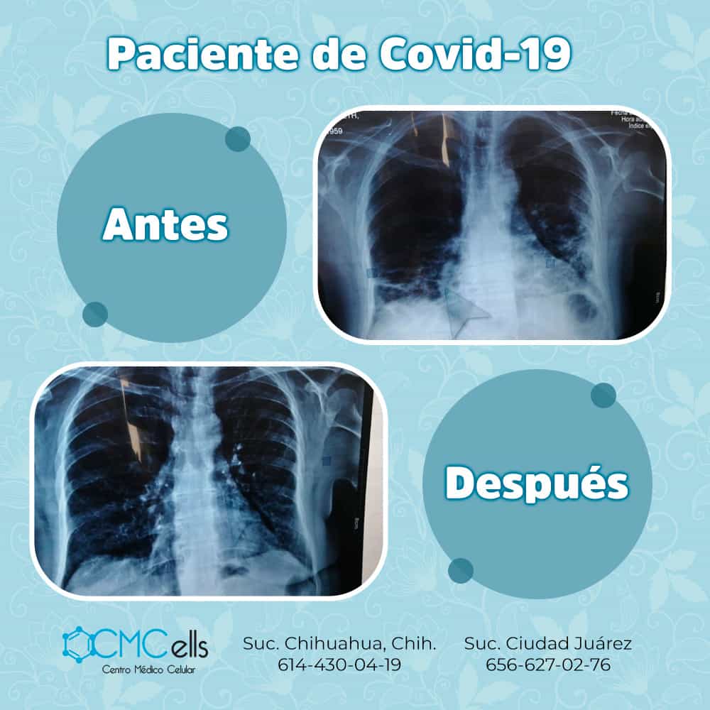 Antes Y Despues Covid Elizabeth