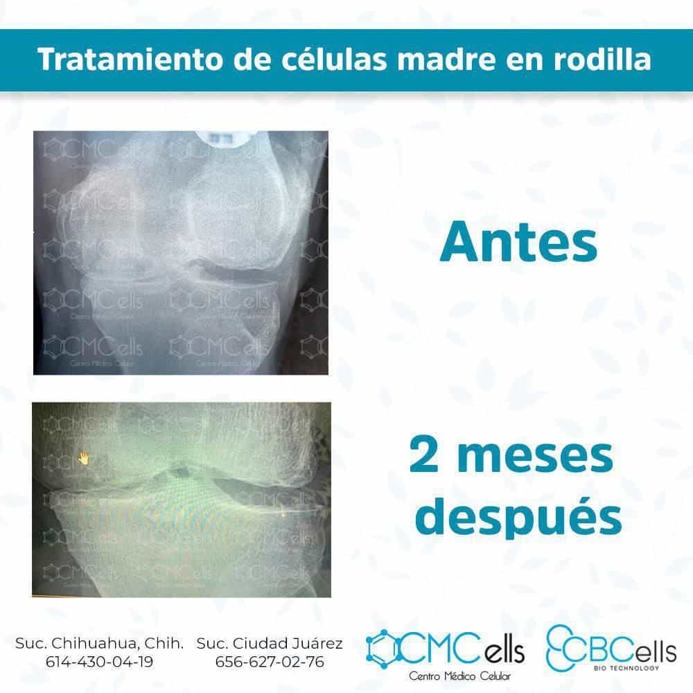 Testimonio Rodila