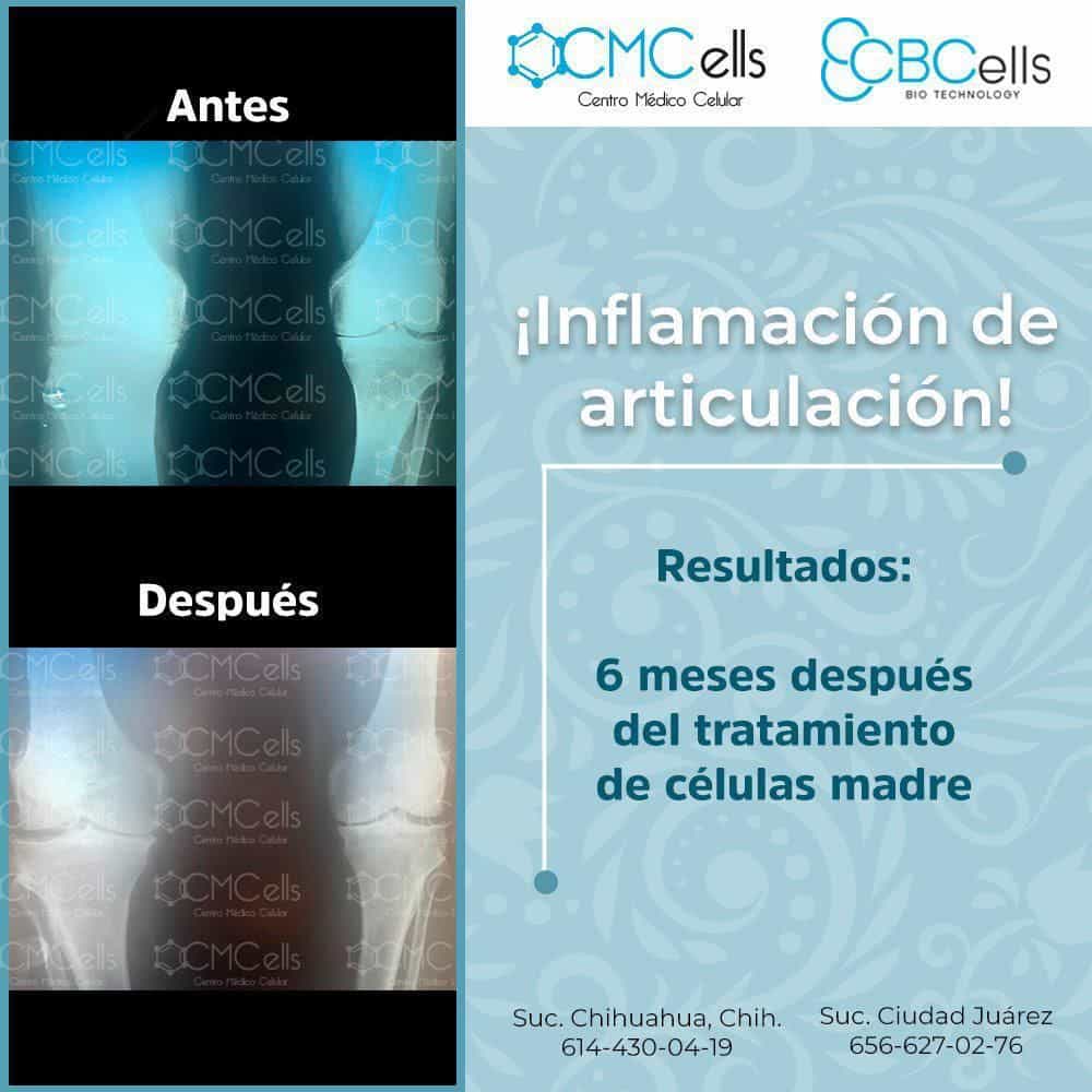 Testimonio Rodilla