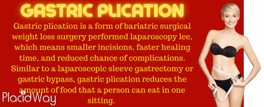 Gastric plication weight loss surgery